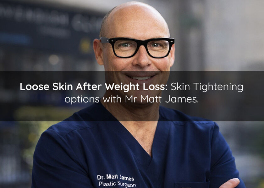Loose Skin After Weight Loss: Skin Tightening options with Mr Matt James